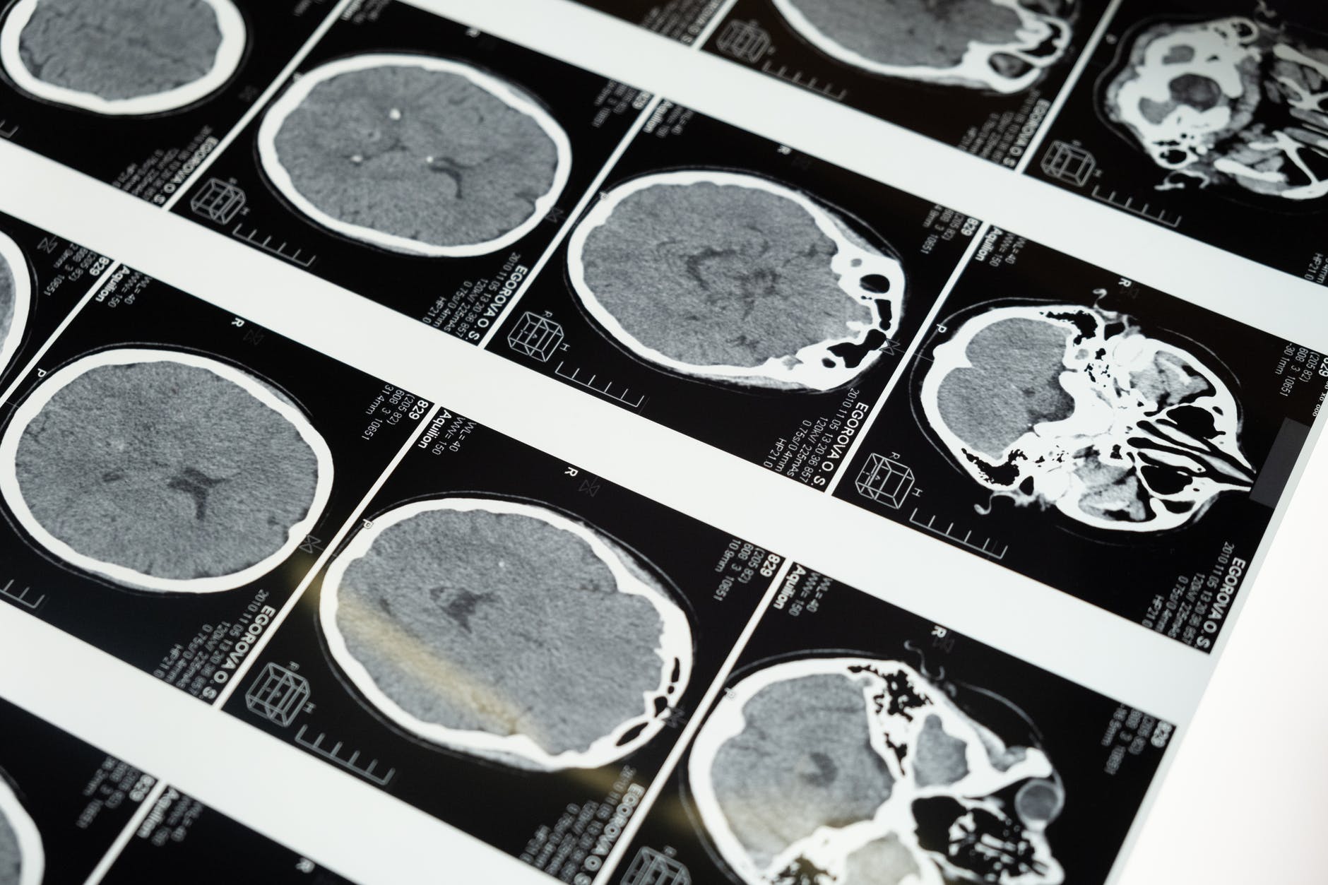 Neurodéveloppement de l&rsquo;enfant : Vrai ou faux ?